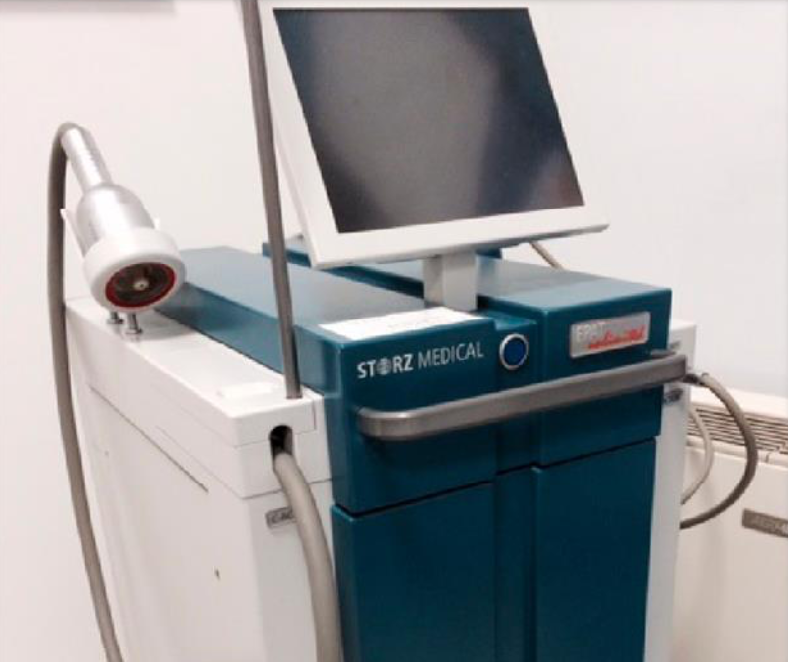 Onde d’Urto Radiali e Focali